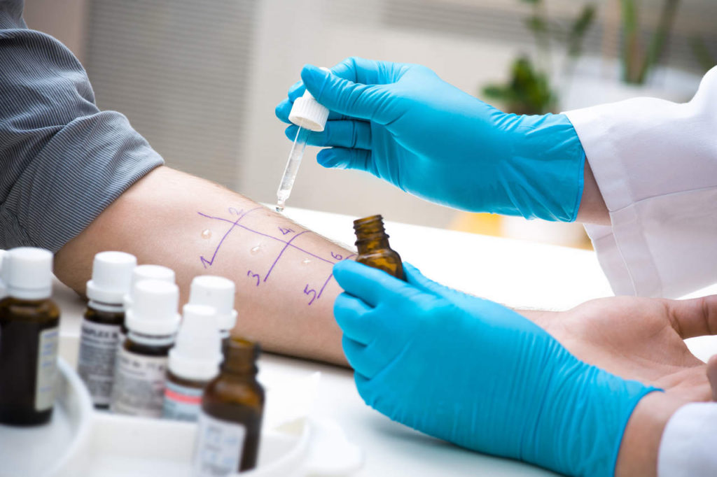 alergia pokarmowa - wykonywanie testu na alergię